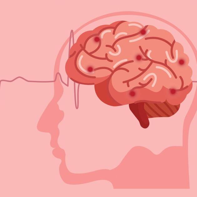 Guadeloupe : une journée pour prévenir l’AVC et sauver des vies