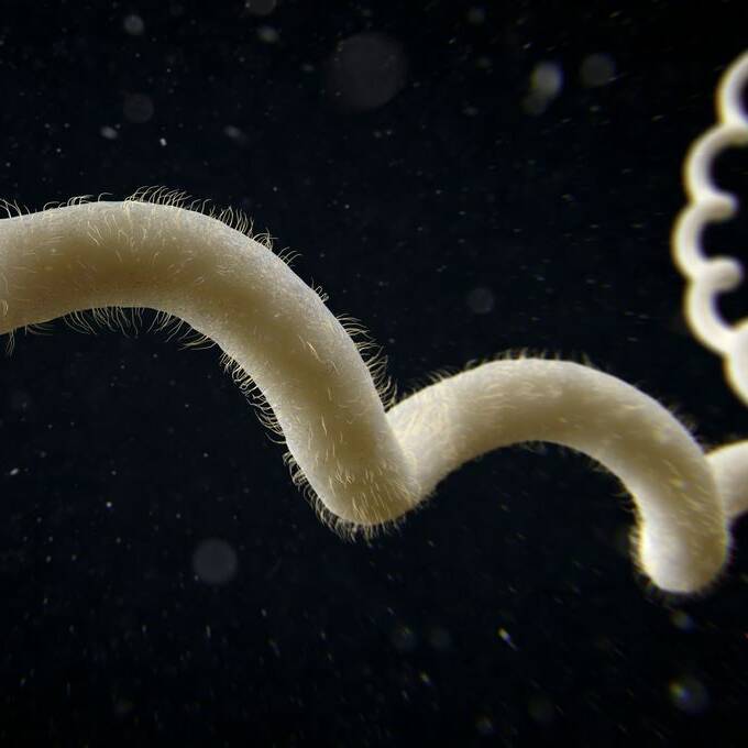 La Réunion : forte hausse des cas de leptospirose, un décès depuis janvier