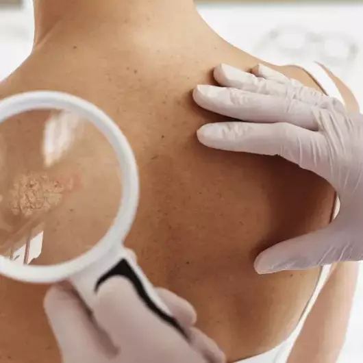 Ambaville, laser et audace péi: une Réunionnaise vise le cancer de la peau depuis la Nouvelle-Zélande